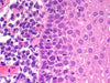 Example of H&E Slide Staining