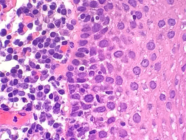 Example of H&E Slide Staining